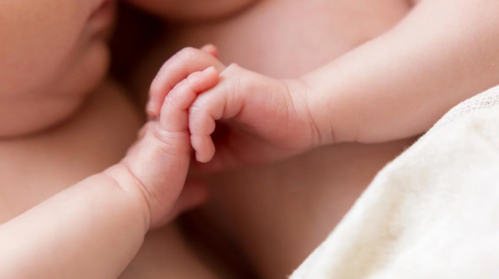 Médicos argentinos separan con éxito a bebés siameses 