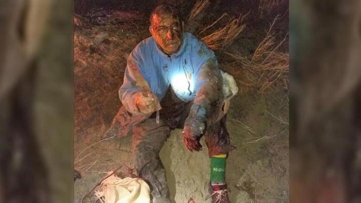 Peleó con un puma para salvar a su perro