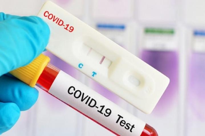 Solo 115 casos de covid: la cifra más baja en 200 días