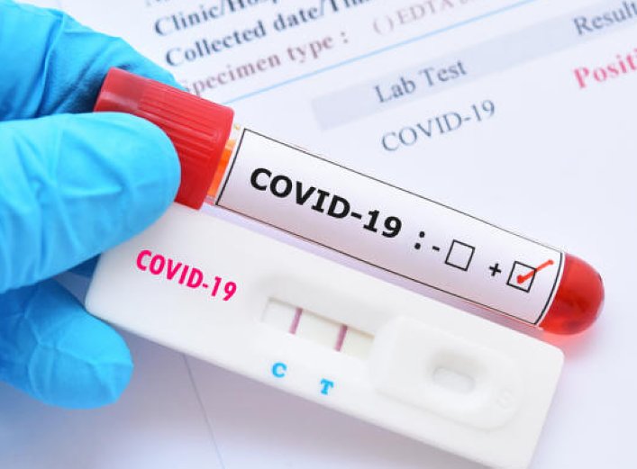 Leve suba de contagios en la provincia de Santa Fe