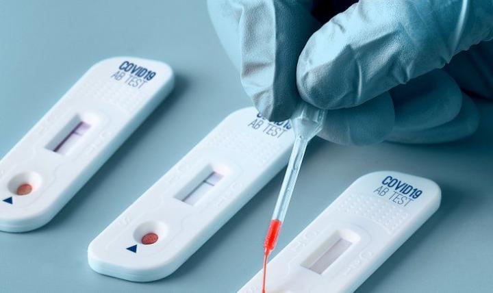 La ANMAT aprobó el uso del autotest de Covid-19