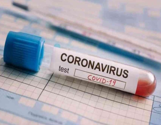 Covid en Santa Fe: 3.768 contagios y ningún fallecido