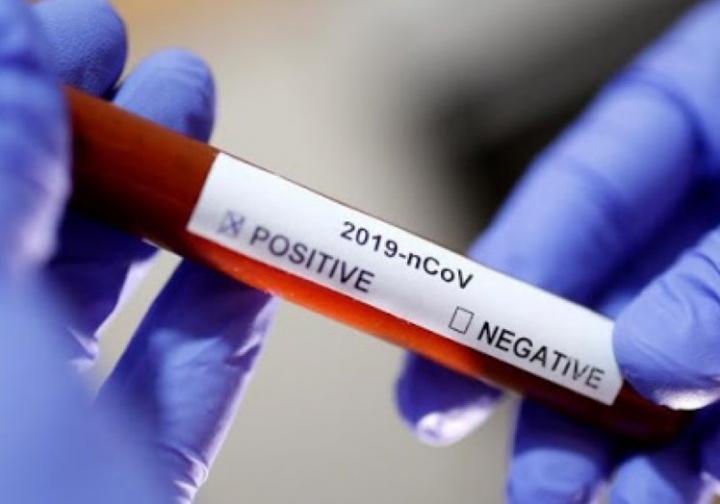 Virólogo de la UNL: “Tenemos claramente un rebrote de covid”