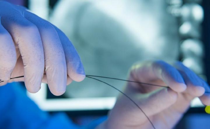 Médicos no colocarán stents ni practicarán angioplastias