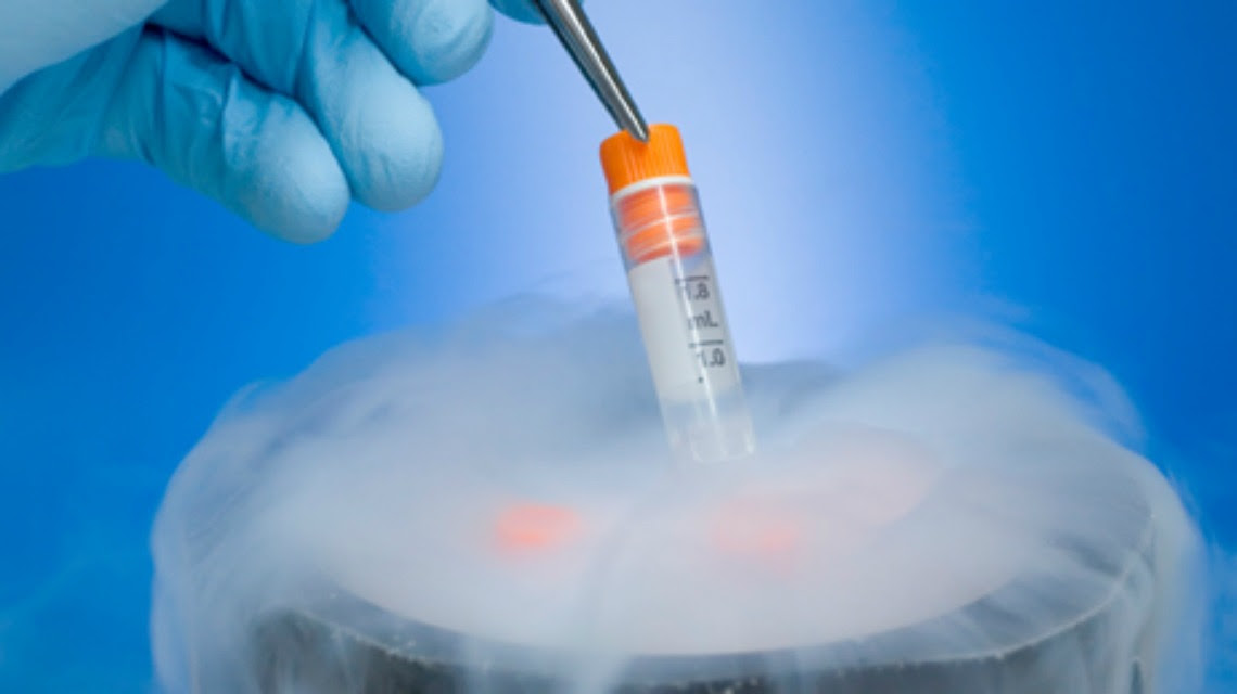 La preservación de la fertilidad de personas con cáncer